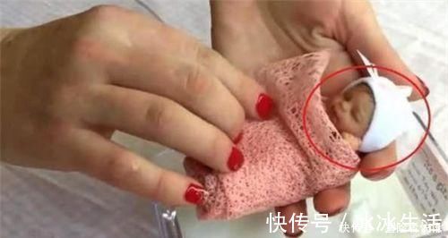 身体|14年过去,原本身体巴掌大“世界最小宝宝”,如今颜值高到认不出