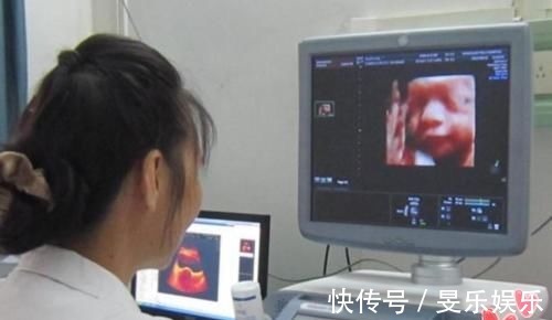 检查|老公陪孕妈做四维,结果不让进,为啥四维检查贴着“家属止步”?
