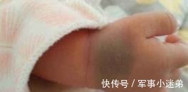 宝宝|若不想让宝宝留下胎记,孕期就别太任性,尽量不要有这4种行为