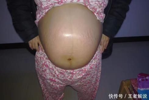 怀孕|促进胎儿入盆,孕晚期要做到这一点,别疏忽了