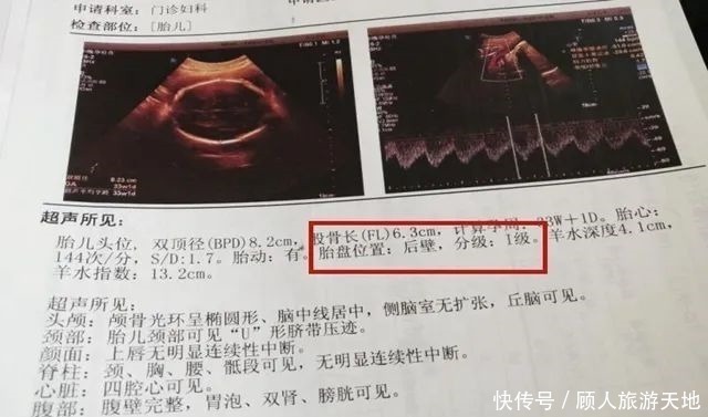 胎儿|四维彩超单上的三个数据,暗示胎儿发育好不好,孕妈学会看更省心
