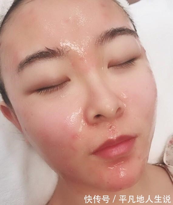 医美 皮肤不好,做医美真的能把皮肤做好吗!