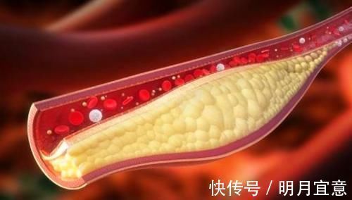 没心没肺|“男性”50岁后,3种病没找上门,恭喜你,有希望成为百岁老人!