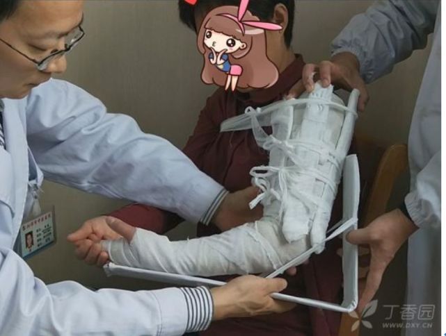 手腕|当心！掰手腕也能导致骨折