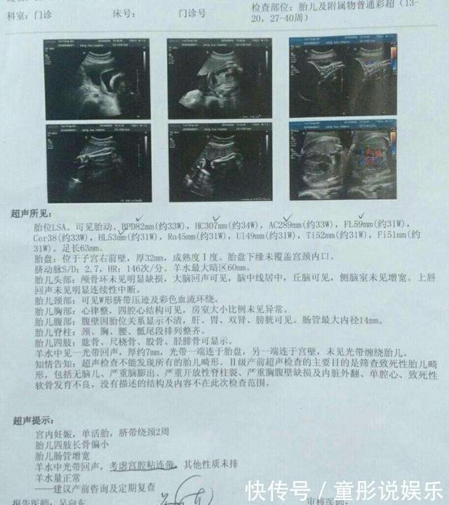 冷汗|生二胎吝啬产检费,7个月B超单一出,脸白了,惊出一身冷汗!