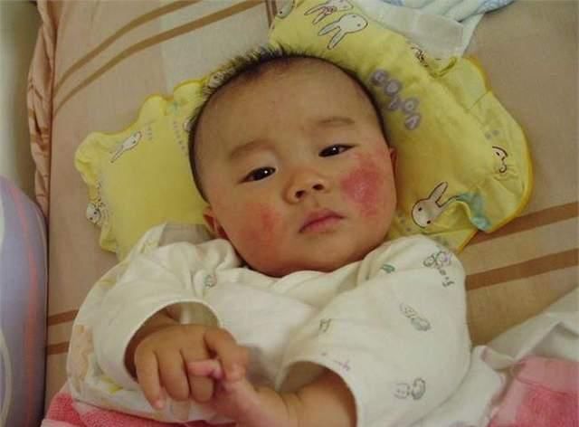 蛋黄|一岁前,十种食物孩子还不能吃,家长千万别掉以轻心