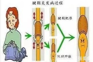 腰疼|说说大家的月子病,让没坐月子的或将坐月子的借鉴一下?