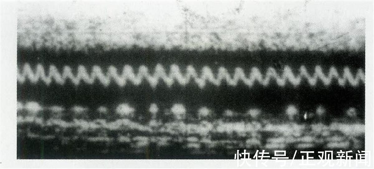 新闻记者|“现代超声心动图之父”王新房去世，享年87岁