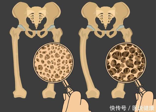受孕|女性缺乏黄体酮时,身体会有5种表现,若没有,说明保养得还不错