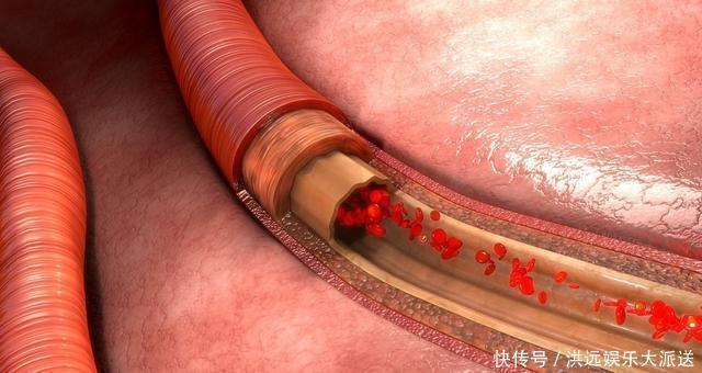 降压药|高血压就怕缺钾，吃什么能补钾医生给您列出清单，别不舍得吃