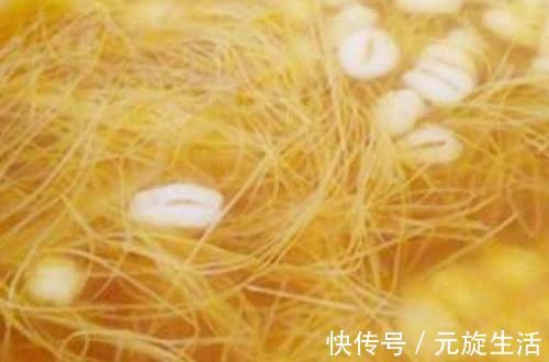 净化|血管堵了不用慌, 每天吃点“它”, 帮你净化血管, 清走血栓