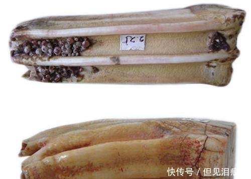 体内|揭秘舍利子之谜。原来很多人都误解了。