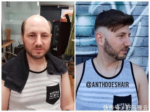 男士|戴假发的四大误区,每一个都让人尴尬到爆,你做对了吗?