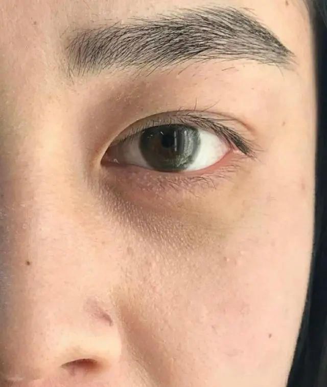 眼霜涂了总是没效果？手法不对，还会长脂肪粒，看你是不是！