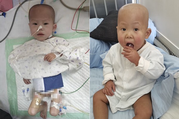 济南儿童医院|孕妈为保胎坚持卧床5个月,第35周产女,接着一家人就陷入困境