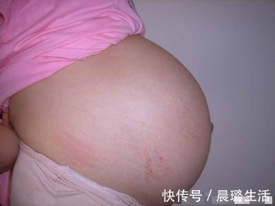 宝宝|剖腹产宝宝和顺产宝宝有区别,并不是智力的高低,而是这三点