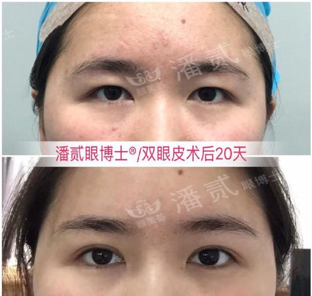 眉弓骨高的人