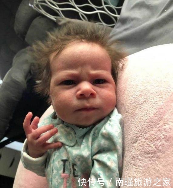 外国|外国女子切除部分子宫后仍怀孕,剖腹产诞下“生气宝宝”