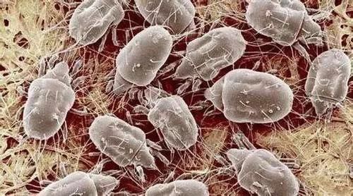 洗床单时,在水里加一点“它”,只要1分钟就可以去除螨虫