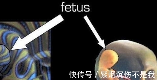 吓坏|四岁男童肚子很大,刚开始以为是肿瘤,真相吓坏所有人!