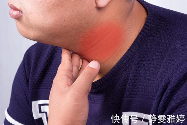 检出率|查出甲状腺结节怎么办别慌,多吃三物,结节或许能“不药而愈”