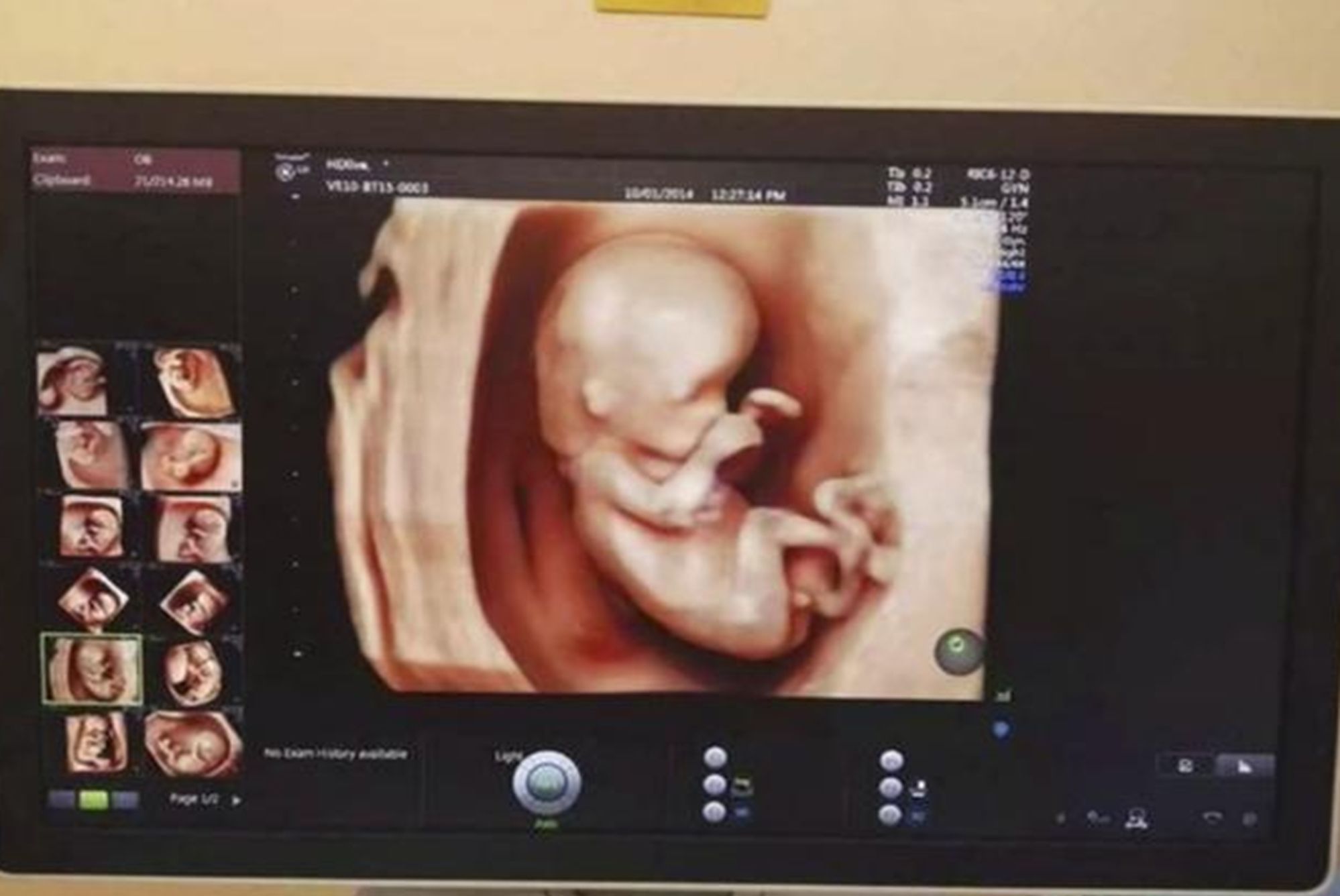 b超检查|孕期B超去几次?新手妈妈们别再问医生了,“孕期检查表”收好