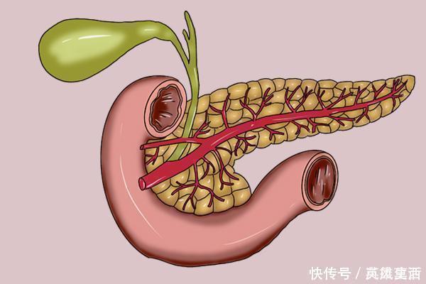 高手|激活胰岛素的“高手”，并非苦瓜南瓜，而是1件事，糖友要记住