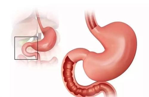 肠胃疾病|胃不好三分治七分养!养胃护胃:常吃3黄,常喝2粥,做好1事