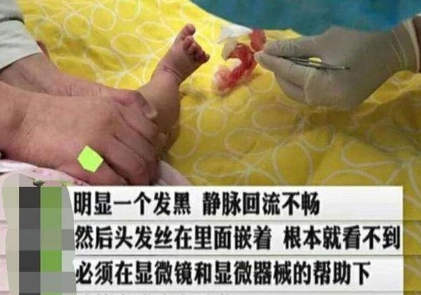 宝宝|2岁宝宝脚趾有“虫子”，妈妈连忙带去检查，医生幸好来得及时