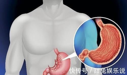 胃部|胃癌发生前期,可能身体有4个变化,若你没有,那身体还不错