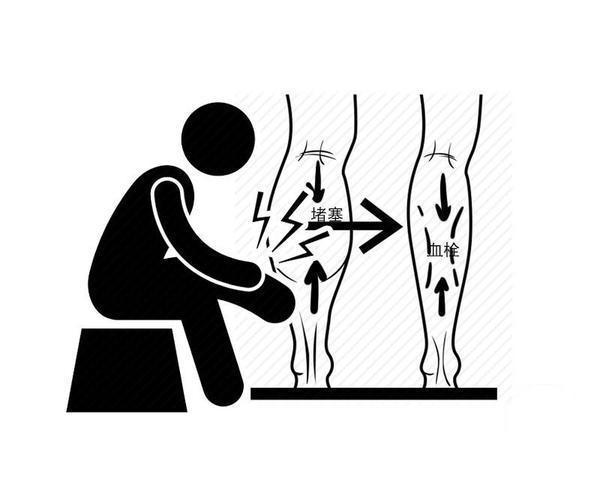 疼痛|血管有栓,腿部先知?忽视腿上2个现象,血栓发生或许你都未察觉