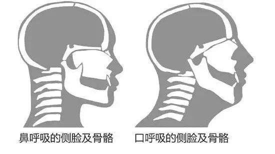 法令纹|可怕！走路吃饭有这个习惯的女生，真的会越来越丑……