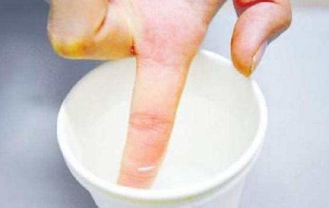 手上粘着502胶水，不用担心，用一个小东西擦一擦，立马干净