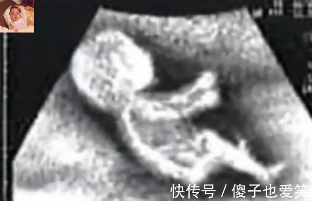 晨练|除了睡觉,胎儿如何每天在肚子里都干啥宝宝小日子开心到飞起