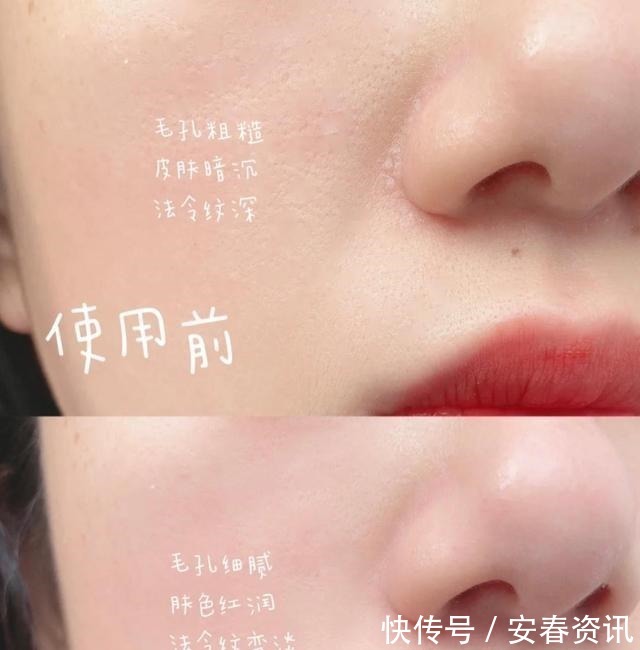 六胜肽 药店有一种“不起眼”面霜,淡化细纹抗初老,可惜知道的人不多!