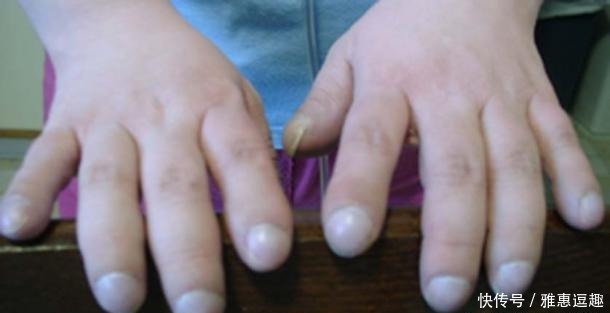 名医|敢和中医叫板?古希腊名医“希波克拉底”到底有多大本事?