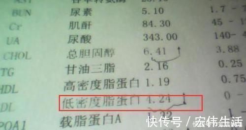 食物|脑血管堵，家中可多备2种食物，天天煮水喝，疏通软化血管防脑梗