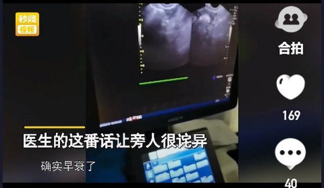 月经不调|37岁女子想怀孕，医生检查后无奈叹息：你要是早一点认识我就好了！