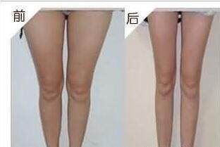 阳气盛|为什么瑜伽包含很多跪姿的体式，看完后跪姿原来有这么多好处 ！