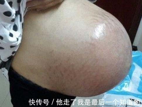 医院|女子婚后一直未孕,38岁意外怀孕,医院产下孩子,丈夫痛哭流涕