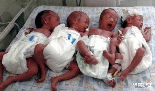 双胞胎|姐妹俩同一天生下2对双胞胎,经医生鉴定,4个孩子爸爸是同一人