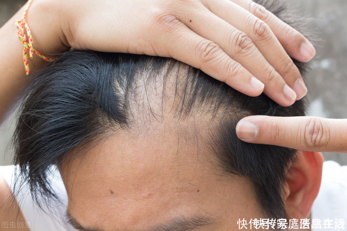 衰老期|男性近半年身体有6个表现，说明正在加速衰老？望你一个也没有