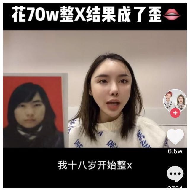 真实颜值|美女网红花70万却整形失败,磨骨伤到神经毁容,自叹非常后悔
