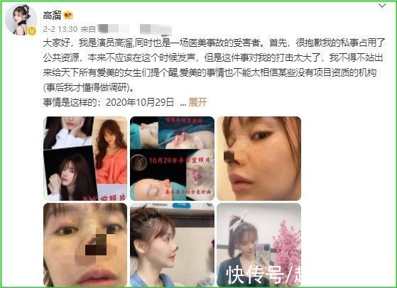 整形 14岁少女面容似老人！童年创伤靠整形挽救？各路整容乱象惹众议