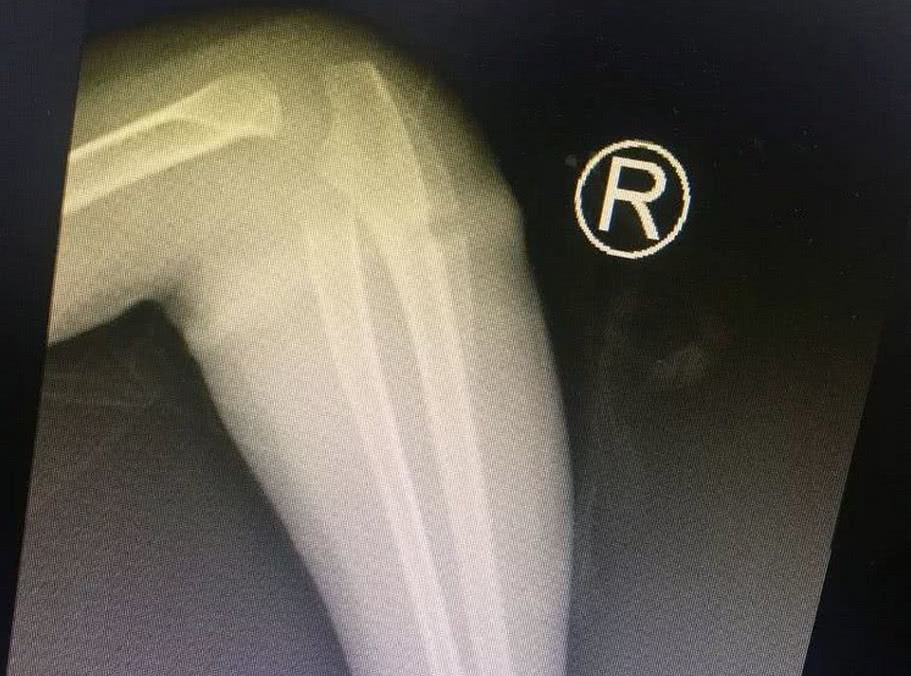 橡皮筋|4岁女孩得怪病,医生检查后,忍不住训斥父母心真大