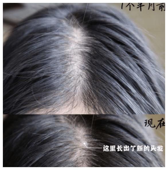 为什么当代年轻人纷纷“嫌弃”超市大牌洗发水，反倒更爱新国货？