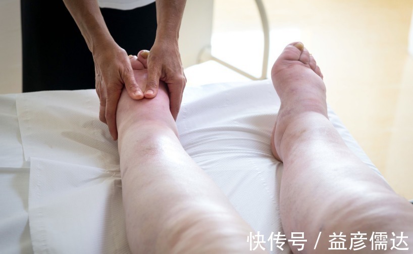 葡萄糖|糖尿病人出现3种异常,或许是尿毒症的前兆,劝你多多注意