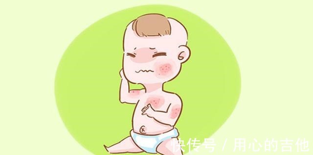护理|宝宝湿疹如何护理及时做好3件事,能大大缓解症状!