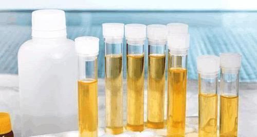 肺部“干净”的人,一般会有4个特征,若你没有,趁早保养