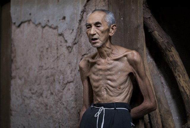 风险|千金难买老来瘦错!老来瘦不健康,60岁后,这样的体重才最长寿